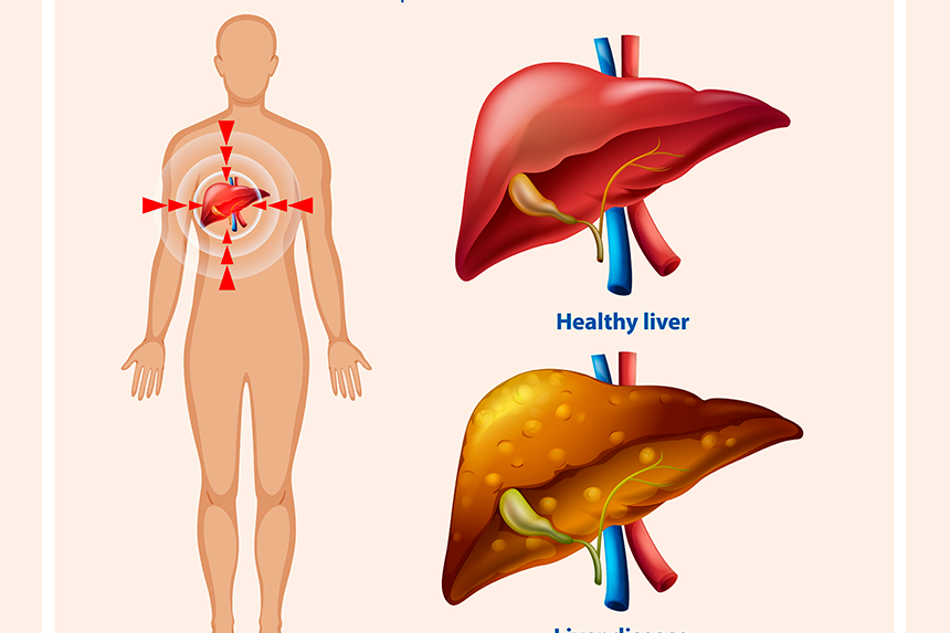 Impacto do açúcar no metabolismo hepático e o processo de regeneração celular profunda